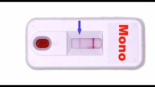 Rapid Mono Test How Does it Work [upl. by Norek791]