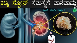 ಕಿಡ್ನಿ ಸ್ಟೋನ್ ಸಮಸ್ಯೆಗೆ ಮನೆಮದ್ದು  Kidney Stone Mane Maddu Kannada  Kidney Stones Symptoms Kannada [upl. by Llevol154]