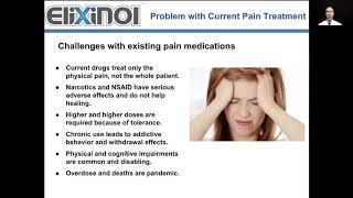 CBD and Chronic Pain [upl. by Doehne568]