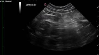 Feline Pancreatitis Video [upl. by Yahsel300]