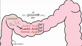 Hepatic Encephalopathy and Lactulose [upl. by Anytsirk]