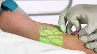 AccuVein AV500 Venipuncture Tip [upl. by Aicat]