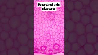 Monocot root under microscope 🔬college bsc botany [upl. by Gherardo]