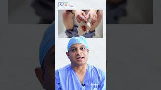 Warning Signs of Rectal Cancer You Shouldnt Ignore  Dr Nilesh Chordiya SSO [upl. by Entroc]