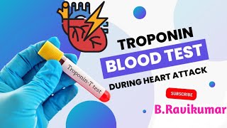 What is a Troponin test in Telugu  How is the tropt test done  Why do you do it  BRavikumar [upl. by Ardaid101]