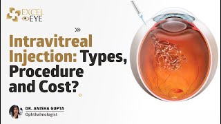 Intravitreal Injection Types Procedure and Cost Dr Anisha Gupta  Eye Specialist Delhi Excel Eye [upl. by Illom]