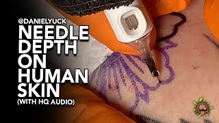 Needle Depth On Human Skin With HQ Audio [upl. by Armitage]