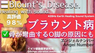 ✅ブラウント病 ★骨が彎曲するO脚の原因にも〓Blounts Disease Relax amp Healing music with Dr Rife [upl. by Adnerak]