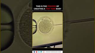 IVF A Journey to Parenthood Through Advanced Fertility Solutions [upl. by Eldwin]