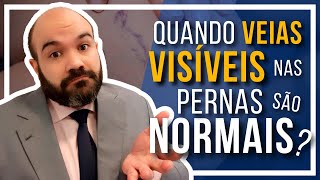 🔴 Veias visíveis nas pernas Quando são NORMAIS [upl. by Namrak535]