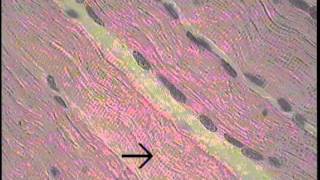 Skeletal Muscle Histology FreeMedEd [upl. by Brower]