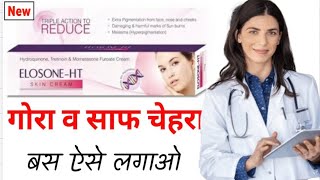 Elosone ht Skin Cream Kaise Use kare  Elosone ht skin cream side effects [upl. by Milewski19]