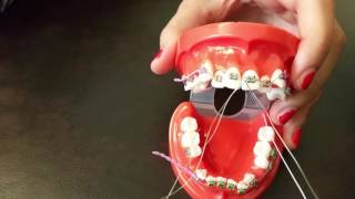 Placing a stainless steel ligature wire for Braces [upl. by Melton]