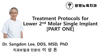 Treatment Protocols for Lower 2nd Molar Single Implant PART 1 [upl. by Ardnatal]