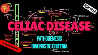 CELIAC DISEASE Pathogenesis Diagnostic markers HLADQ28 Antibodies Biopsy Treatment Explained [upl. by Whitten]