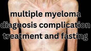 Understanding Multiple Myeloma Diagnosis Treatment and Fasting [upl. by Tnomed]