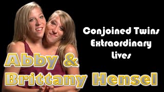 The Inspiring Journey of Conjoined Twins Abby and Brittany Hensel amp Embracing Lifes Challenges [upl. by Ettennan790]