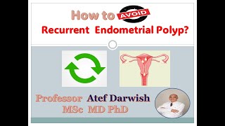 How to avoid Recurrent Endometrial polyp [upl. by Sapowith]