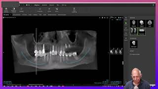 Dental Treatment Planning in a Medically Compromised Case [upl. by Scarlet]