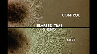 8 Response of Cells to Nerve Growth Factor NGF [upl. by Sadnac921]