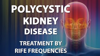 Polycystic Kidney Diseases  RIFE Frequencies Treatment  Energy amp Quantum Medicine Bioresonance [upl. by Nahraf]