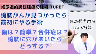 経尿道的膀胱腫瘍切除術 TURBTとはどんな手術か [upl. by Derfniw579]