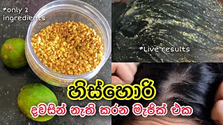 එක දවසින් හිස්හොරි නැති කරන මැජික් එක 😮  Dandruff Treatments at home dandruff haircare [upl. by Breeze]