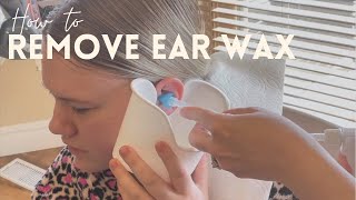 Amazing Ear Wax Removal [upl. by Persas]