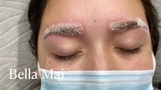 Eyebrow Salt and Saline Removal [upl. by Chang]