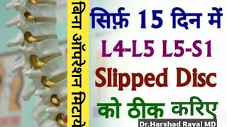 L4 L5 Slip Disc l Herniated Disc l Disc Protruded l Disc Extrusion बिना ऑपरेशन 100 मिटाये कमर दर्द [upl. by Allisan]