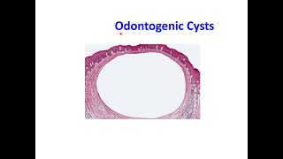 Odontogenic Cysts [upl. by Wanda]