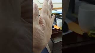 Aedes albopictus Mosquito blood feeding on my hand in the office خونخواری پشه از دستم داخل اداره 🦟 [upl. by Anitsuga206]