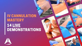 Intravenous IV cannulation compilation with demonstration of 14 procedures [upl. by Skinner]