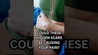 Could These Hidden Scars Be Causing Your Pain facts ahorts [upl. by Costanzia]