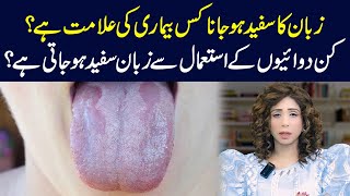 Common Diseases Indicated by a White Tongue Symptoms and Causes  Dr Sahar Chawla [upl. by Sirraf]