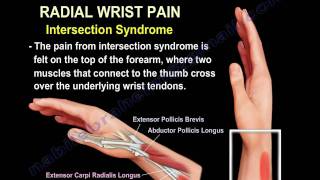 Wrist Paincauses and treatmentPart 2  Everything You Need To Know  Dr Nabil Ebraheim [upl. by Oguh]