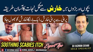 How to stop itching with expert advice Scabies treatment [upl. by Bascomb]