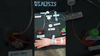 Haemodialysis working model made by our group shorts shortsfeed [upl. by Ahsil673]