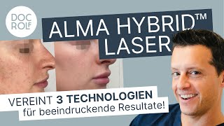 Neu ALMA CO2 HYBRID™ LASER  die Innovation der Hautverjüngung  Dr Rolf amp Katrin Bartsch [upl. by Nroht]