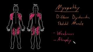 Syndrome Myopathy [upl. by Isle]