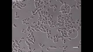 Livecell imaging of conidial anastomosis tube fusion during colony initiation in Fusarium oxysporum [upl. by Enyawad579]