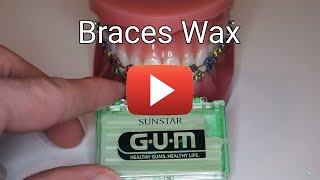 Braces Wax [upl. by Doralynne]