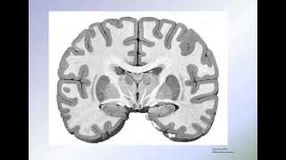 Histologie du neocortex [upl. by Akenaj]