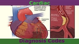 Common Cardiac Diagnosis Codes You Need To Know [upl. by Husch]