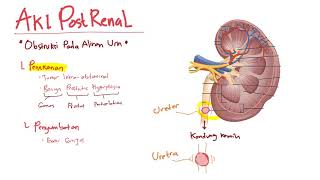 Patofisiologi  Cidera Ginjal Akut Postrenal  Azotemia  Acute Kidney Injury [upl. by Ardnikal]