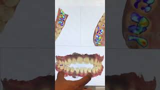 Invisalign Time Lapse  Invisalign Braces  Invisalign Before After invisalignsmile clearaligner [upl. by Atonsah701]