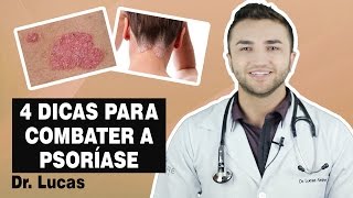 4 Dicas para COMBATER a Psoríase  Dr Lucas Fustinoni [upl. by Oivatco]