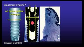 Jan Lindhe The BioManagement Complex part 2 [upl. by Estas]