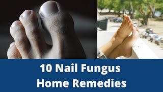 10 Nail Fungus Home Remedies [upl. by Neelahtak380]