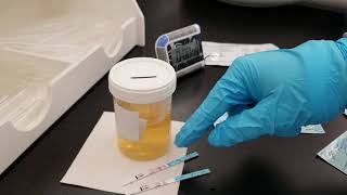 Chemistry Urine Fertility Screening Tests [upl. by Aneroc815]